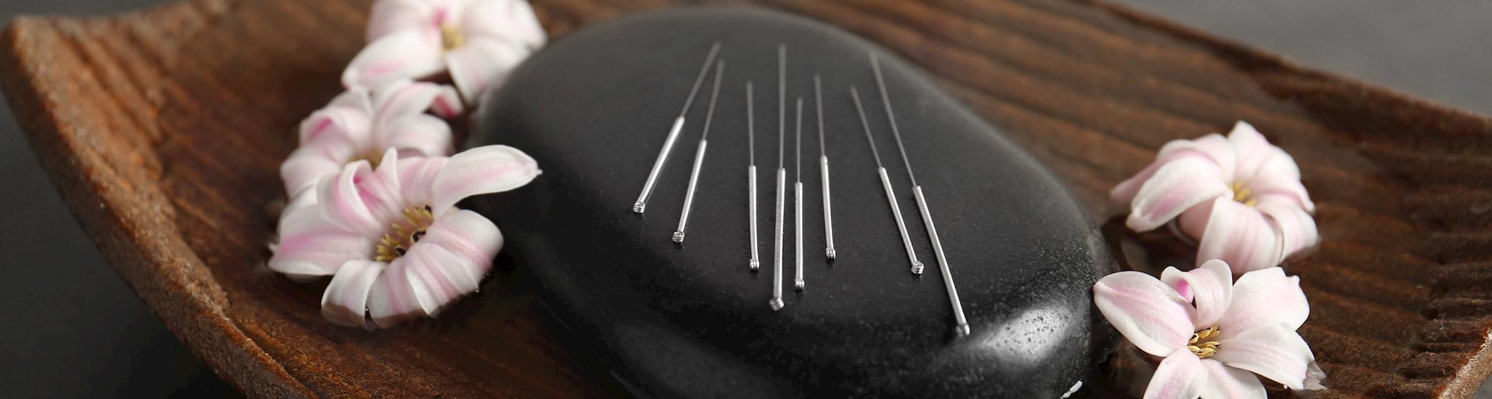 Acupuncture role in fertility & Pregnancy